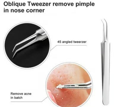 3 Pcs Professional Blackhead Tweezers