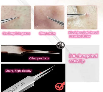 3 Pcs Professional Blackhead Tweezers