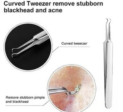 3 Pcs Professional Blackhead Tweezers